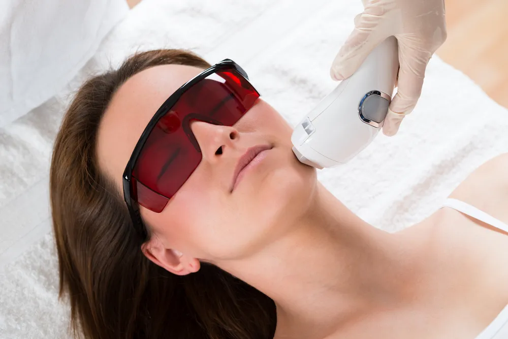 Chin & Upper Neck Laser Hair Reduction