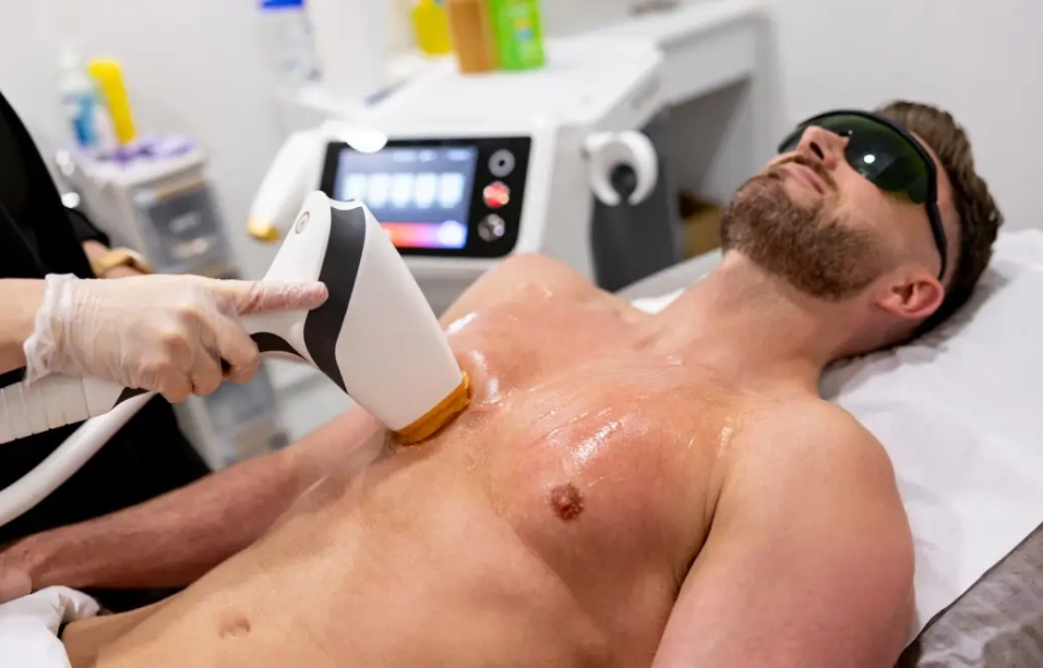 Full Body Laser Hair Reduction for Men