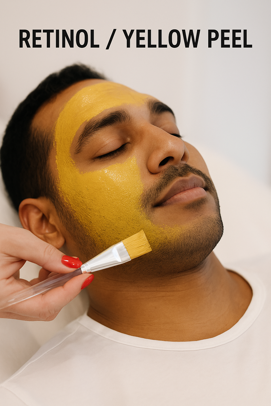 Retinol Peel / Yellow Peel
