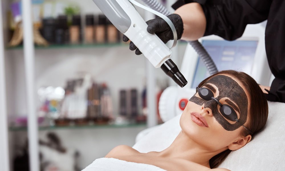 Carbon Facial (Laser Peel)