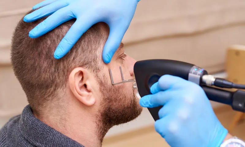 Fractional CO₂ Laser (Deep Tan & Scarring)